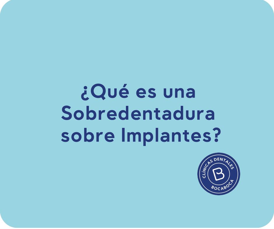 selladores dentales clinica dental en malaga clinica bocaboca