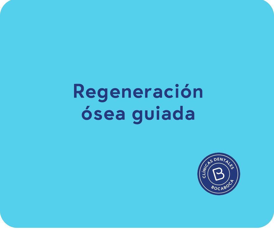 selladores dentales clinica dental en malaga clinica bocaboca