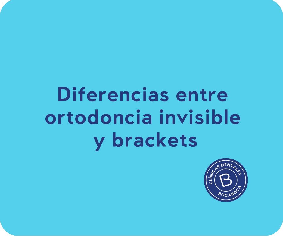 selladores dentales clinica dental en malaga clinica bocaboca