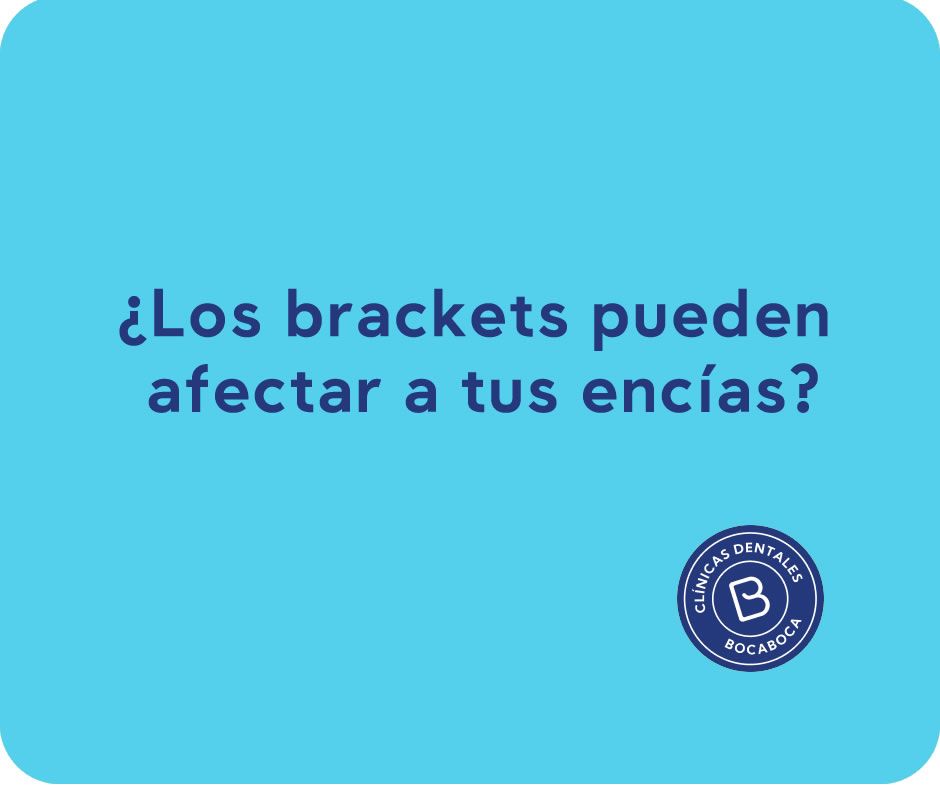 selladores dentales clinica dental en malaga clinica bocaboca